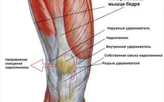 Отчего могут болеть мышцы над коленями?