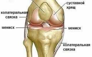 Восстановление мениска: домашнее лечение или операция?