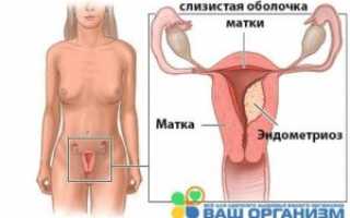 Появление коричневых выделений перед месячными