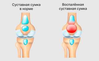 Боль в колене и ее причины у взрослых и детей