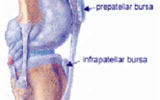 Виды бурситов коленного сустава: препателлярный, инфрапателлярный и супрапателлярный