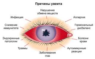 Что выявляет магнитно-резонансная томография глаз
