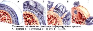 Степени ДОА