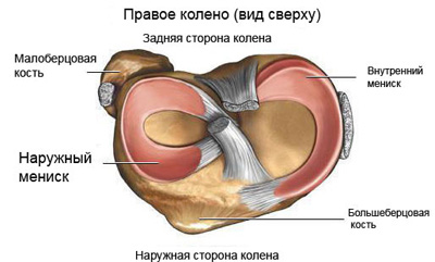 Схема менисков коленного сустава